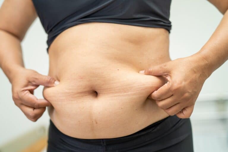 overweight woman holding her stomach