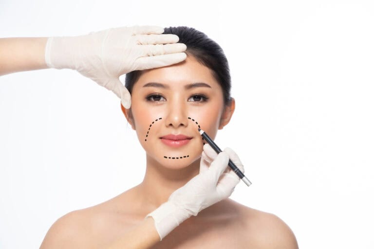 Lines on face, close up, plastic surgery making marks on patient's face for jowl liposuction
