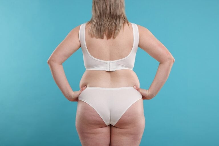 fat back patient in underwear