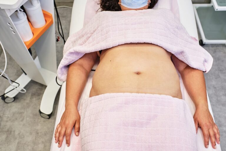 exposed abdomen of liposuction patient in bed