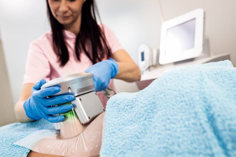 actual cryolipolysis treatment