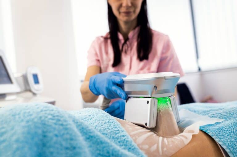 close up view of cryolipolysis treatment