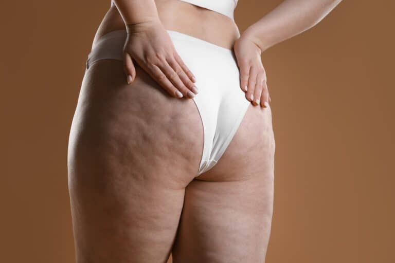 woman with cellulite brown background