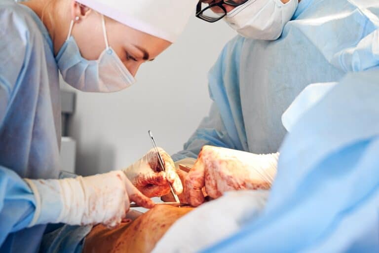 medical team performing liposuction