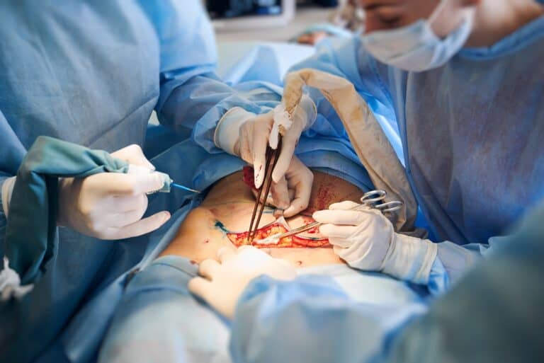 surgeons actual surgery