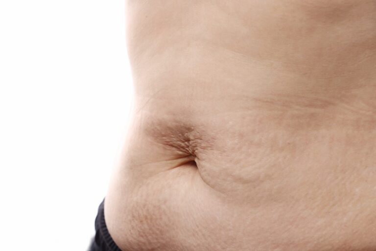 close up of fibrosis complication