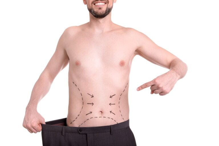 man with marks on belly wearing oversize pants