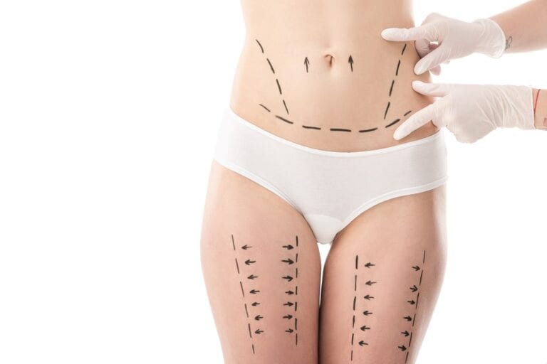 cropped view of plastic surgeon on latex gloves