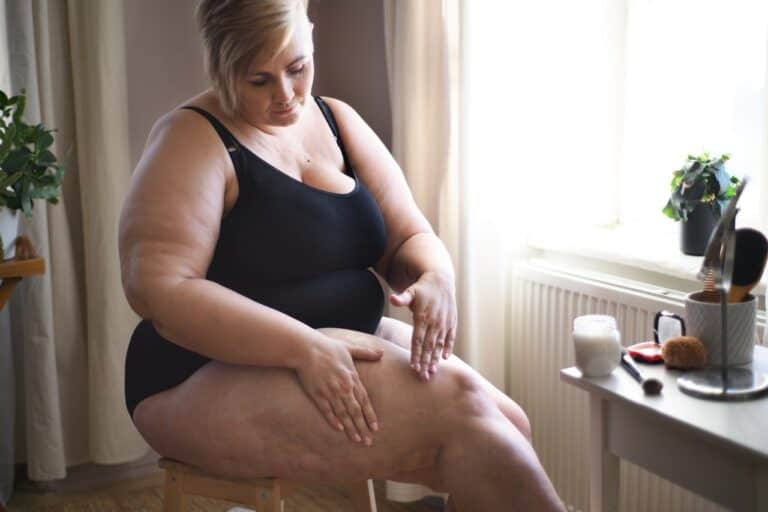 fat woman applying cream on legs