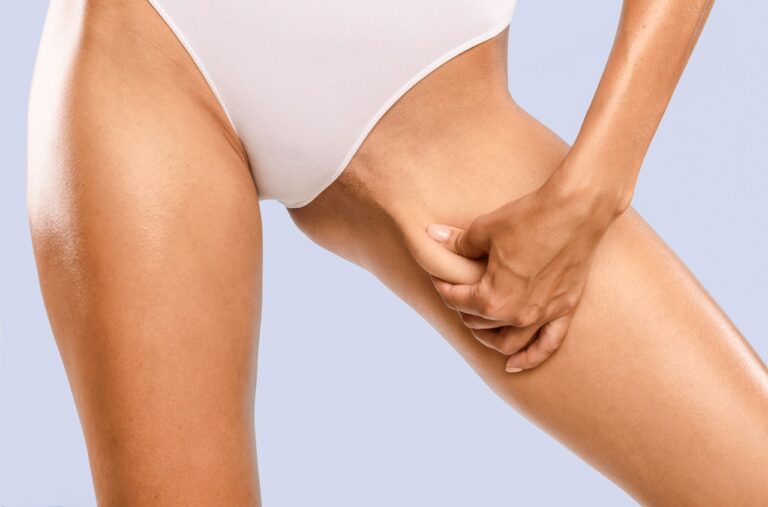 slim woman with inner thigh fat