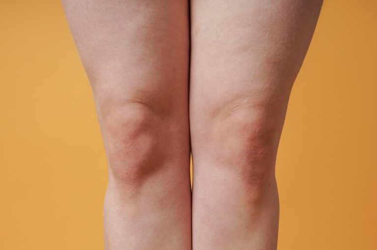 female knees and legs in yellow background