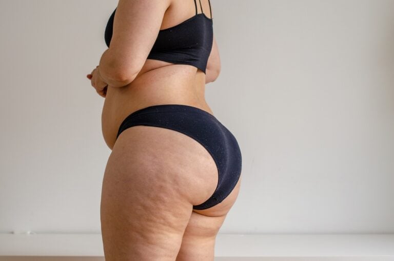 overweight woman in black bikini