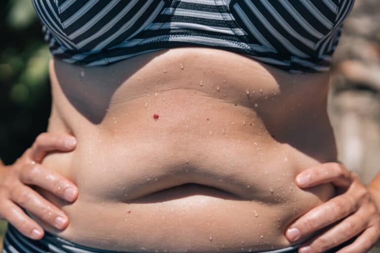 woman's belly showing in a bikini