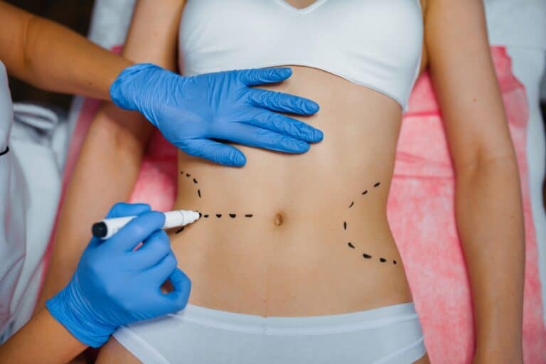 surgeon using a marker to draw lines on patient