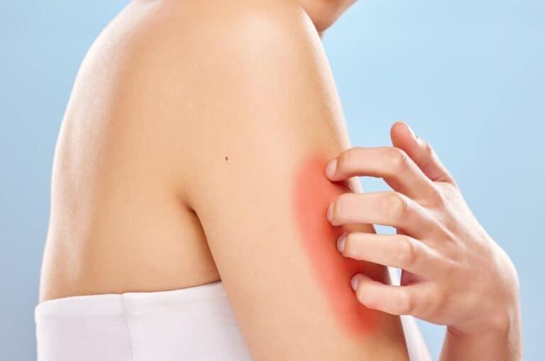 woman scratching her arm